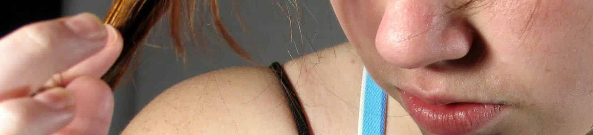 Sudden Hair Loss in Women