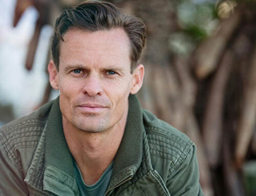 Assessing Your Candidacy for a Hair Transplant